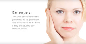 Why ear surgery