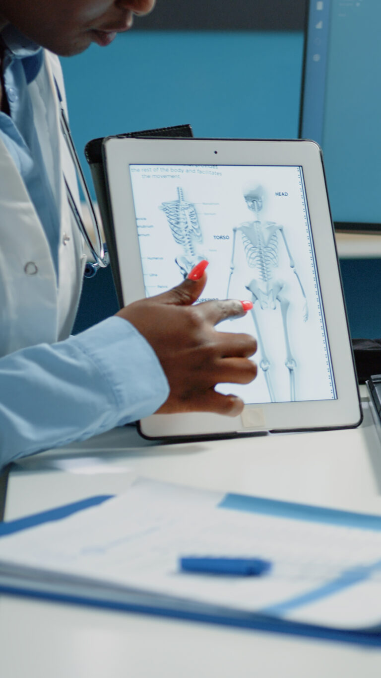 Why Is DEXA Scanning Crucial for Managing Osteoporosis?