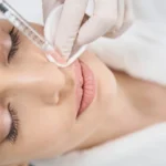 Filler Treatments