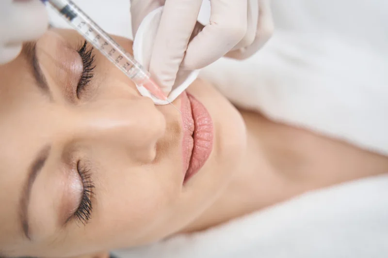 Filler Treatments