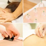 How Does Acupuncture in Singapore Support Pain and Stress Relief? tcm tuina Singapore